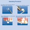 Tor Vm Transparent Crowns 64 Pcs - Anterior No. 1.910 - Image 3