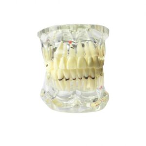 Mixed Dentition Pathology Model