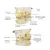 Mixed Dentition Pathology Model - Image 5