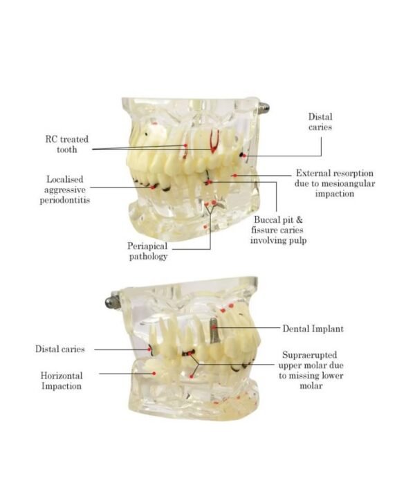 Mixed Dentition Pathology Model - Image 5