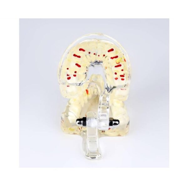 Mixed Dentition Pathology Model - Image 4
