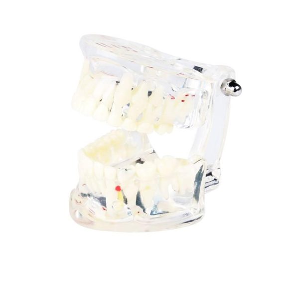 Mixed Dentition Pathology Model - Image 2