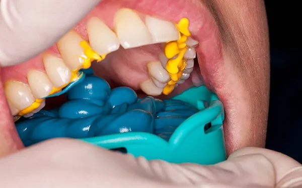 DMG Honigum Putty - Image 4