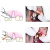 Root Elevator Premium In Pouch REPP9 - Image 2