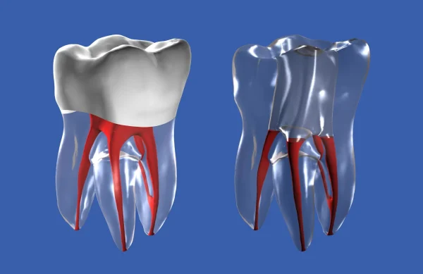 Identical Root Canal (RCT) Practice Tooth - Image 10