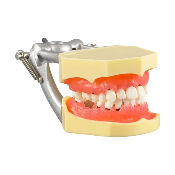 Identical Periodontal Model M4003 - Image 3