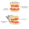 Identical Periodontal Model M4003 - Image 2