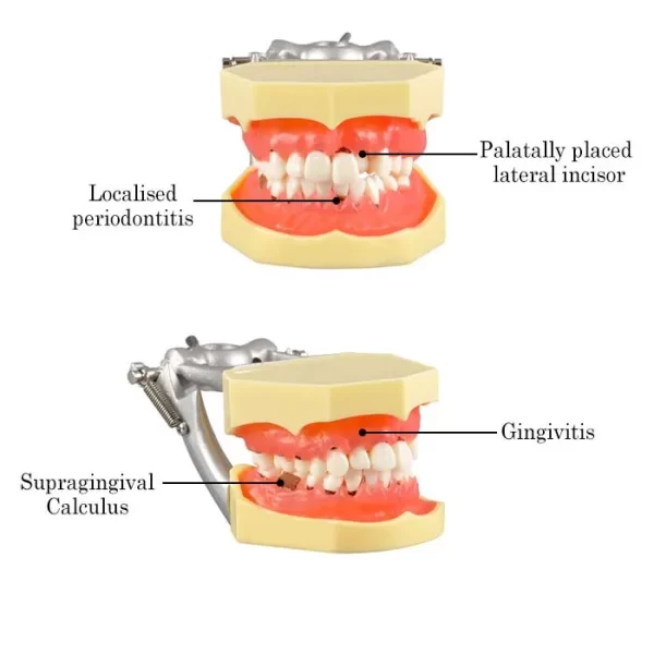 Identical Periodontal Model M4003 - Image 2
