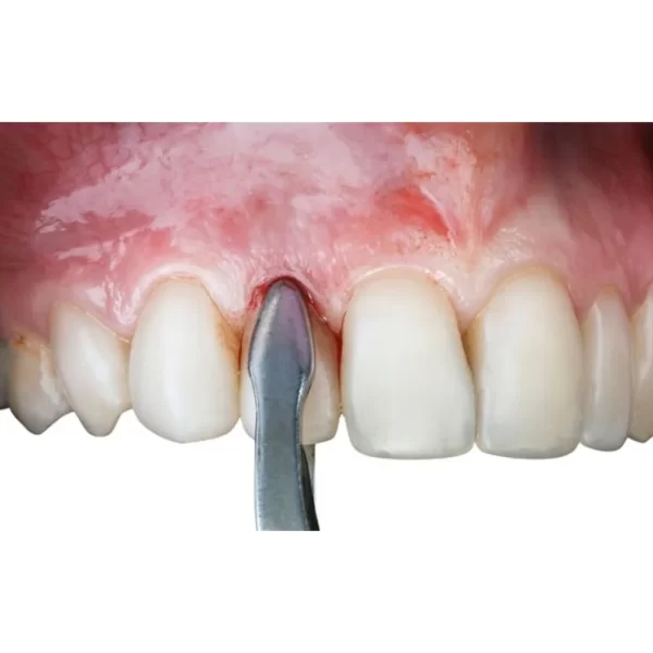 Extraction Forceps Premium In Pouch EFPP12 - Image 2