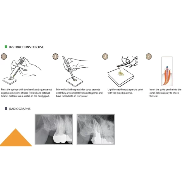 Diadent Dia-Proseal - Image 3