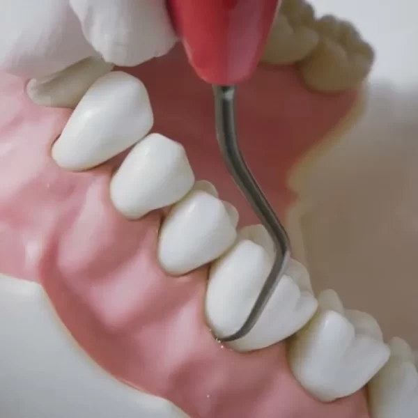 Gracey Curette Color Coded #SGCC9/10 - Image 2