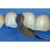 QuickmatFLEX Premolar Sectional Matrices 50Pcs - Image 2