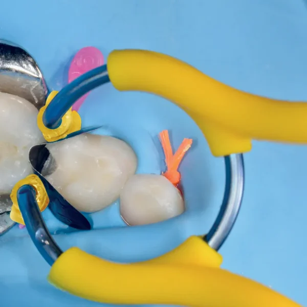 Polydentia myJunior Paediatric Sectional Matrix System Kit - Image 2