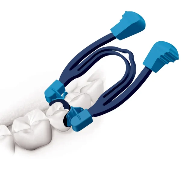 Polydentia MyClip 2.0 Secional Matix System Kit - Image 2
