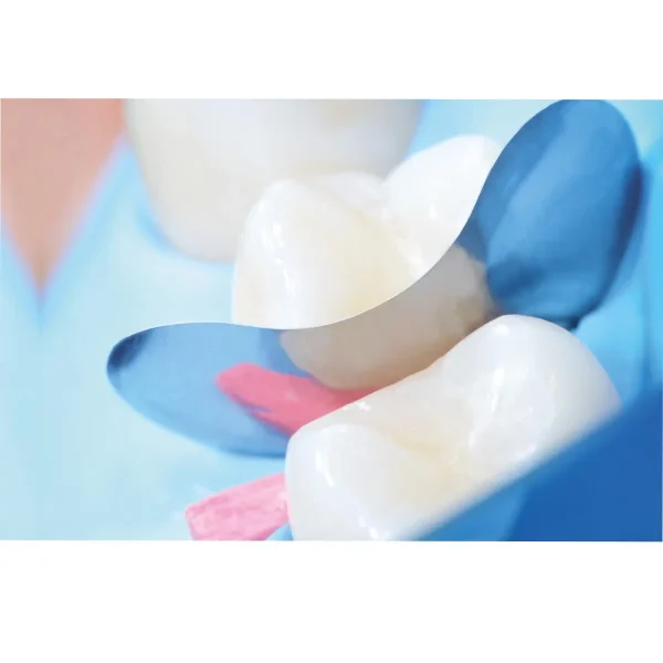 QuickmatFLEX Molar Deep Sectional Matrices 50Pcs - Image 3