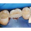 Fiber Splint (1 Layer 4mm X 2mtr With 5 Clips) - Image 3