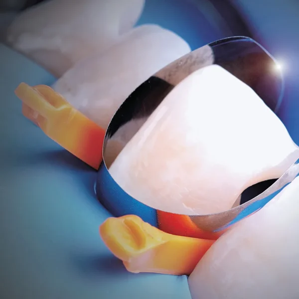 Polydentia Unica Anterior Matrix System Intro Kit - Image 2